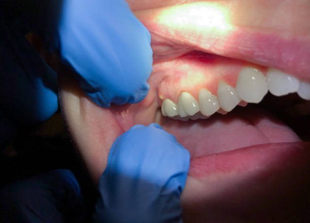 Best Emergency Cosmetic Dentistry (e.g., broken veneers) in Fritz Creek, AK