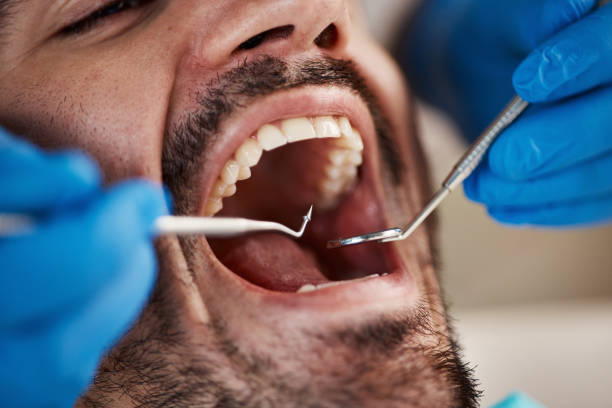 Best Emergency Care for Gum Disease in Fritz Creek, AK