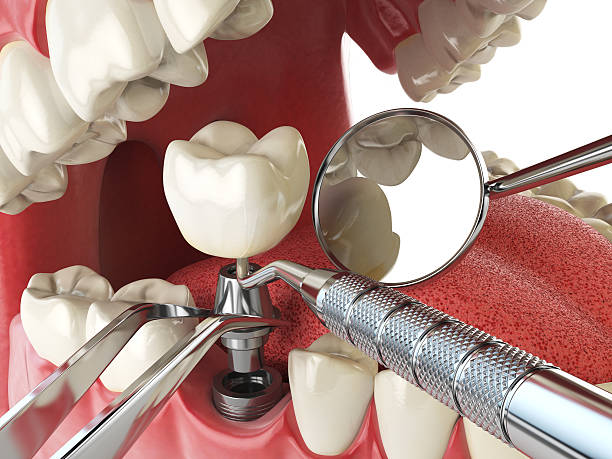 Best Emergency Cosmetic Dentistry (e.g., broken veneers) in Fritz Creek, AK